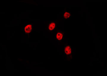 POLR2J Antibody - Staining HepG2 cells by IF/ICC. The samples were fixed with PFA and permeabilized in 0.1% Triton X-100, then blocked in 10% serum for 45 min at 25°C. The primary antibody was diluted at 1:200 and incubated with the sample for 1 hour at 37°C. An Alexa Fluor 594 conjugated goat anti-rabbit IgG (H+L) Ab, diluted at 1/600, was used as the secondary antibody.