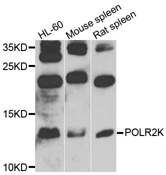 POLR2K Antibody - Western blot analysis of extracts of various cells.