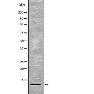 POLR2K Antibody - Western blot analysis of RPAB4 using Jurkat whole cells lysates