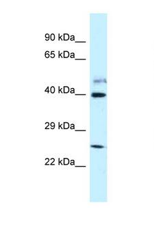 POLR2M Antibody - GRINL1A antibody Western blot of Fetal Lung lysate. Antibody concentration 1 ug/ml.  This image was taken for the unconjugated form of this product. Other forms have not been tested.