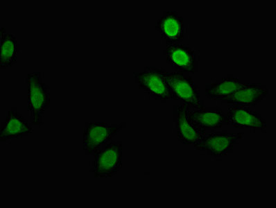 POLR2M Antibody - Immunofluorescent analysis of A549 cells at a dilution of 1:100 and Alexa Fluor 488-congugated AffiniPure Goat Anti-Rabbit IgG(H+L)