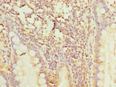 POLR3A Antibody - Immunohistochemistry of paraffin-embedded human small intestine tissue using POLR3A Antibody at dilution of 1:100