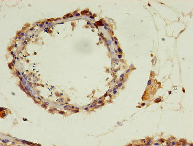 POLR3A Antibody - Immunohistochemistry of paraffin-embedded human testis tissue using POLR3A Antibody at dilution of 1:100