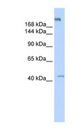 POLR3A Antibody - POLR3A antibody Western blot of Fetal Muscle lysate. This image was taken for the unconjugated form of this product. Other forms have not been tested.