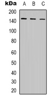 POLR3A Antibody - Western blot analysis of POLR3A expression in K562 (A); MCF7 (B); COS7 (C) whole cell lysates.