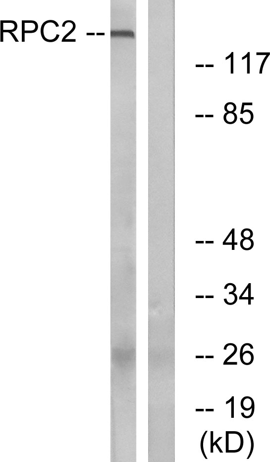 POLR3B Antibody - Western blot analysis of lysates from LOVO cells, using RPC2 Antibody. The lane on the right is blocked with the synthesized peptide.