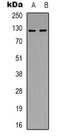 POLR3B Antibody - Western blot analysis of POLR3B expression in HeLa (A); HepG2 (B) whole cell lysates.