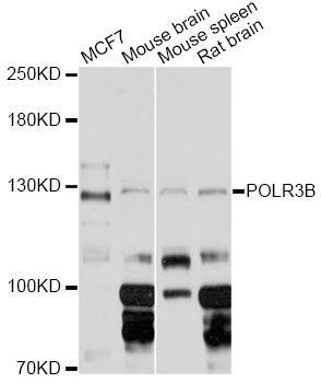 POLR3B Antibody - Western blot analysis of extracts of various cell lines, using POLR3B Antibody at 1:3000 dilution. The secondary antibody used was an HRP Goat Anti-Rabbit IgG (H+L) at 1:10000 dilution. Lysates were loaded 25ug per lane and 3% nonfat dry milk in TBST was used for blocking. An ECL Kit was used for detection and the exposure time was 5s.