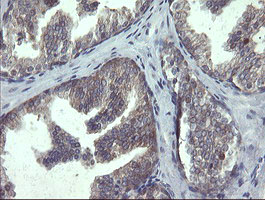 POLR3C Antibody - IHC of paraffin-embedded Human prostate tissue using anti-POLR3C mouse monoclonal antibody.