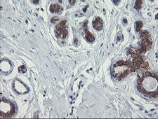 POLR3C Antibody - IHC of paraffin-embedded Human breast tissue using anti-POLR3C mouse monoclonal antibody.