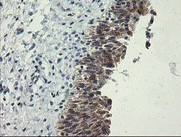 POLR3C Antibody - IHC of paraffin-embedded Human bladder tissue using anti-POLR3C mouse monoclonal antibody.