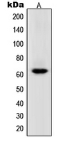 POLR3C Antibody - Western blot analysis of POLR3C expression in HeLa (A) whole cell lysates.