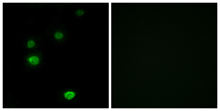 POLR3E / SIN Antibody - Immunofluorescence analysis of LOVO cells, using RPC5 Antibody. The picture on the right is blocked with the synthesized peptide.
