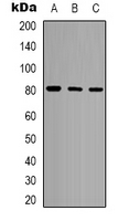 POLR3E / SIN Antibody - Western blot analysis of POLR3E expression in HeLa (A); Jurkat (B); Ramos (C) whole cell lysates.