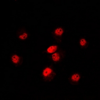 POLR3E / SIN Antibody - Immunofluorescent analysis of POLR3E staining in HeLa cells. Formalin-fixed cells were permeabilized with 0.1% Triton X-100 in TBS for 5-10 minutes and blocked with 3% BSA-PBS for 30 minutes at room temperature. Cells were probed with the primary antibody in 3% BSA-PBS and incubated overnight at 4 deg C in a humidified chamber. Cells were washed with PBST and incubated with a DyLight 594-conjugated secondary antibody (red) in PBS at room temperature in the dark. DAPI was used to stain the cell nuclei (blue).