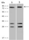 POLR3E / SIN Antibody - Anti-POLR3E rabbit polyclonal antibody at 1:500 dilution. Lane A: HeLa Whole Cell Lysate. Lane B: urkat Whole Cell Lysate. Lysates/proteins at 30 ug per lane. Secondary: Goat Anti-Rabbit IgG (H+L)/HRP at 1/10000 dilution. Developed using the ECL technique. Performed under reducing conditions. Predicted band size: 80 kDa. Observed band size: 80 kDa.