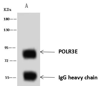 POLR3E / SIN Antibody - POLR3E was immunoprecipitated using: Lane A: 0.5 mg HeLa Whole Cell Lysate. 4 uL anti-POLR3E rabbit polyclonal antibody and 60 ug of Immunomagnetic beads Protein A/G. Primary antibody: Anti-POLR3E rabbit polyclonal antibody, at 1:100 dilution. Secondary antibody: Goat Anti-Rabbit IgG (H+L)/HRP at 1/10000 dilution. Developed using the ECL technique. Performed under reducing conditions. Predicted band size: 80 kDa. Observed band size: 80 kDa.