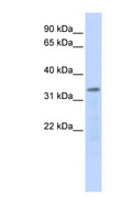POLR3F Antibody - POLR3F antibody Western blot of 721_B cell lysate. This image was taken for the unconjugated form of this product. Other forms have not been tested.