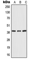 POLR3F Antibody - Western blot analysis of POLR3F expression in HeLa (A); mouse liver (B); rat liver (C) whole cell lysates.