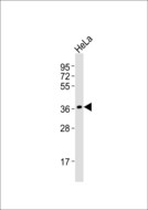 POLR3F Antibody - Anti-POLR3F Antibody at 1:1000 dilution + HeLa whole cell lysates Lysates/proteins at 20 ug per lane. Secondary Goat Anti-Rabbit IgG, (H+L),Peroxidase conjugated at 1/10000 dilution Predicted band size : 36 kDa Blocking/Dilution buffer: 5% NFDM/TBST.