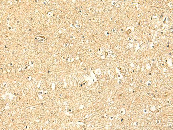 POLR3F Antibody - Immunohistochemistry of paraffin-embedded Human brain tissue  using POLR3F Polyclonal Antibody at dilution of 1:50(×200)