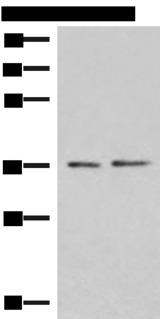 POLR3F Antibody - Western blot analysis of PC-3 and HepG2 cell lysates  using POLR3F Polyclonal Antibody at dilution of 1:500
