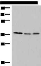 POLR3F Antibody - Western blot analysis of HepG2 Hela and PC-3 cell lysates  using POLR3F Polyclonal Antibody at dilution of 1:350