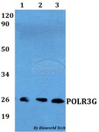 POLR3G Antibody - Western blot of POLR3G antibody at 1:500 dilution. Lane 1: MCF-7 whole cell lysate. Lane 2: Raw264.7 whole cell lysate. Lane 3: H9C2 whole cell lysate.