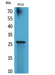 POLR3G Antibody - Western Blot analysis of extracts from PC12 cells using POLR3G Antibody.