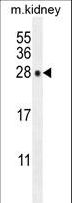 POLR3GL Antibody - POLR3GL Antibody western blot of mouse kidney tissue lysates (35 ug/lane). The POLR3GL antibody detected the POLR3GL protein (arrow).