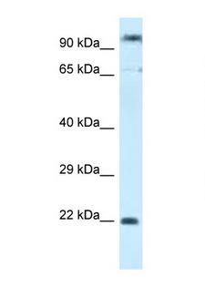 POLR3GL Antibody - POLR3GL antibody Western blot of MCF7 Cell lysate. Antibody concentration 1 ug/ml.  This image was taken for the unconjugated form of this product. Other forms have not been tested.