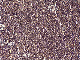 POLR3GL Antibody - IHC of paraffin-embedded Human lymph node tissue using anti-POLR3GL mouse monoclonal antibody. (Heat-induced epitope retrieval by 10mM citric buffer, pH6.0, 120°C for 3min).
