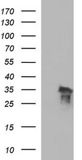 POLR3GL Antibody - HEK293T cells were transfected with the pCMV6-ENTRY control (Left lane) or pCMV6-ENTRY POLR3GL (Right lane) cDNA for 48 hrs and lysed. Equivalent amounts of cell lysates (5 ug per lane) were separated by SDS-PAGE and immunoblotted with anti-POLR3GL.