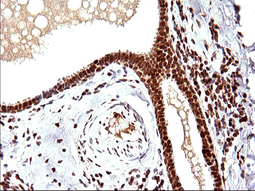 POLR3GL Antibody - IHC of paraffin-embedded Human breast tissue using anti-POLR3GL mouse monoclonal antibody. (Heat-induced epitope retrieval by 10mM citric buffer, pH6.0, 120°C for 3min).
