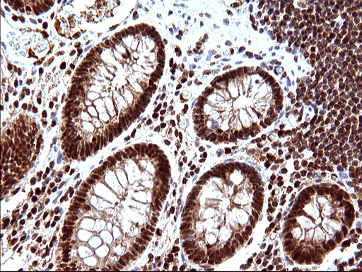 POLR3GL Antibody - IHC of paraffin-embedded Human colon tissue using anti-POLR3GL mouse monoclonal antibody. (Heat-induced epitope retrieval by 10mM citric buffer, pH6.0, 120°C for 3min).