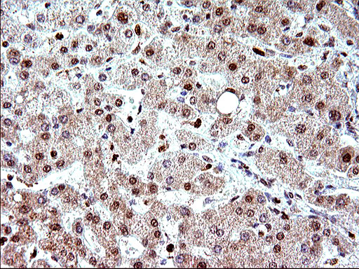 POLR3GL Antibody - IHC of paraffin-embedded Human liver tissue using anti-POLR3GL mouse monoclonal antibody. (Heat-induced epitope retrieval by 10mM citric buffer, pH6.0, 120°C for 3min).
