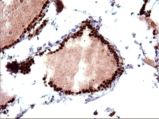 POLR3GL Antibody - IHC of paraffin-embedded Human thyroid tissue using anti-POLR3GL mouse monoclonal antibody. (Heat-induced epitope retrieval by 10mM citric buffer, pH6.0, 120°C for 3min).