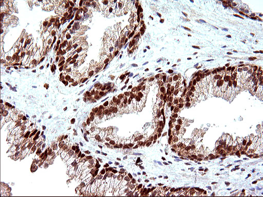 POLR3GL Antibody - IHC of paraffin-embedded Human prostate tissue using anti-POLR3GL mouse monoclonal antibody. (Heat-induced epitope retrieval by 10mM citric buffer, pH6.0, 120°C for 3min).