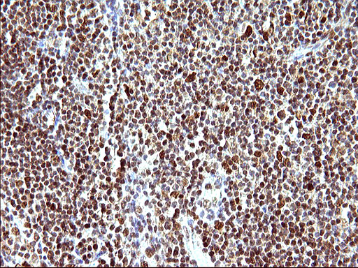POLR3GL Antibody - IHC of paraffin-embedded Human lymph node tissue using anti-POLR3GL mouse monoclonal antibody. (Heat-induced epitope retrieval by 10mM citric buffer, pH6.0, 120°C for 3min).