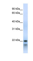 POLR3H Antibody - POLR3H antibody Western blot of Fetal Muscle lysate. This image was taken for the unconjugated form of this product. Other forms have not been tested.