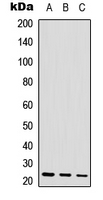 POLR3H Antibody - Western blot analysis of POLR3H expression in HEK293T (A); mouse heart (B) whole cell lysates.