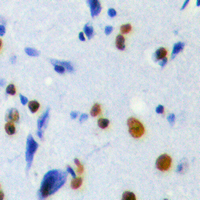 POLR3H Antibody - Immunohistochemical analysis of POLR3H staining in human brain formalin fixed paraffin embedded tissue section. The section was pre-treated using heat mediated antigen retrieval with sodium citrate buffer (pH 6.0). The section was then incubated with the antibody at room temperature and detected using an HRP conjugated compact polymer system. DAB was used as the chromogen. The section was then counterstained with hematoxylin and mounted with DPX.