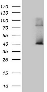 POLR3H Antibody - HEK293T cells were transfected with the pCMV6-ENTRY control. (Left lane) or pCMV6-ENTRY POLR3H. (Right lane) cDNA for 48 hrs and lysed