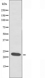 POLR3H Antibody - Western blot analysis of extracts of K562 cells using RPC8 antibody.