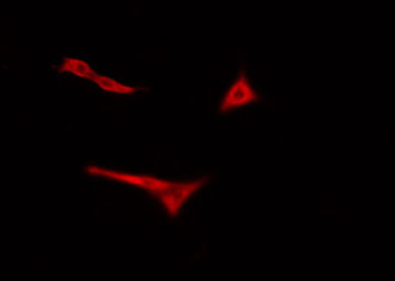 POLR3H Antibody - Staining HeLa cells by IF/ICC. The samples were fixed with PFA and permeabilized in 0.1% Triton X-100, then blocked in 10% serum for 45 min at 25°C. The primary antibody was diluted at 1:200 and incubated with the sample for 1 hour at 37°C. An Alexa Fluor 594 conjugated goat anti-rabbit IgG (H+L) antibody, diluted at 1/600, was used as secondary antibody.