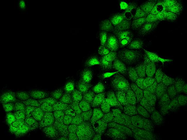 POLR3H Antibody - Immunofluorescence staining of POLR3H in A431 cells. Cells were fixed with 4% PFA, permeabilzed with 0.1% Triton X-100 in PBS, blocked with 10% serum, and incubated with rabbit anti-Human POLR3H polyclonal antibody (dilution ratio 1:200) at 4°C overnight. Then cells were stained with the Alexa Fluor 488-conjugated Goat Anti-rabbit IgG secondary antibody (green). Positive staining was localized to Nucleus and Cytoplasm.