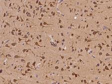 POLR3H Antibody - Immunochemical staining of human POLR3H in human brain with rabbit polyclonal antibody at 1:100 dilution, formalin-fixed paraffin embedded sections.