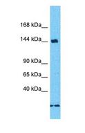POM121 Antibody - Western blot of POM121 Antibody with human Fetal Liver lysate.  This image was taken for the unconjugated form of this product. Other forms have not been tested.