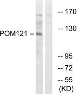 POM121 Antibody - Western blot analysis of extracts from K562 cells, using POM121 antibody.