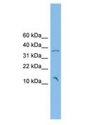 POM121C Antibody - POM121 antibody Western Blot of PANC1 cell lysate.  This image was taken for the unconjugated form of this product. Other forms have not been tested.
